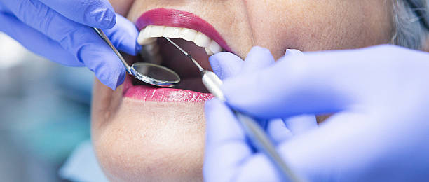 Best Emergency Wisdom Tooth Extraction in Homer, IL
